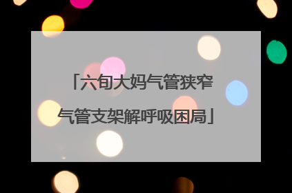 六旬大妈气管狭窄 气管支架解呼吸困局